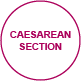 birth caesareansection